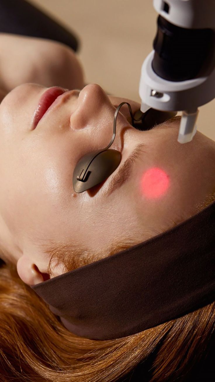 Why Microneedling Is a Game-Changer for Skin Health