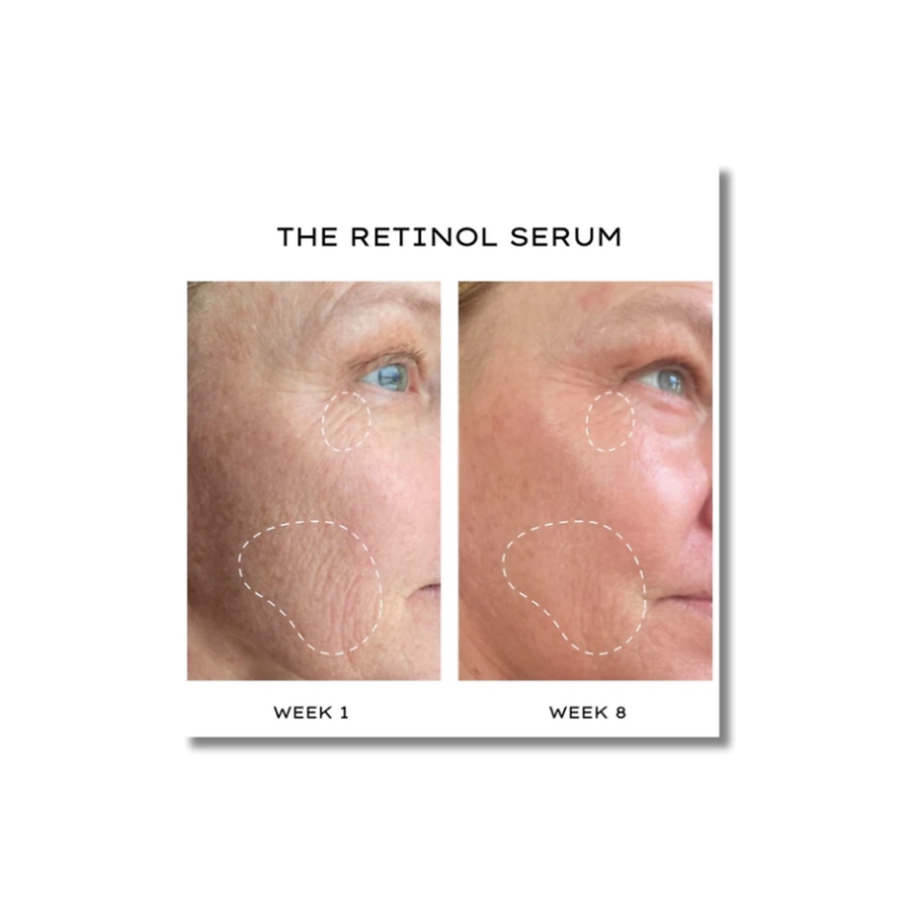 The Retinol Serum