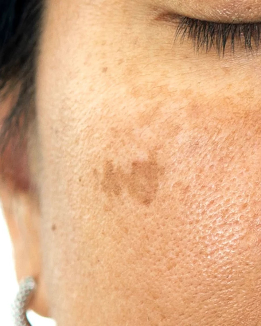 Dark Spot & Pigmentation Defence